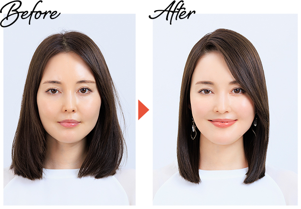 Before→After