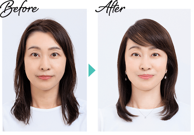 Before→After