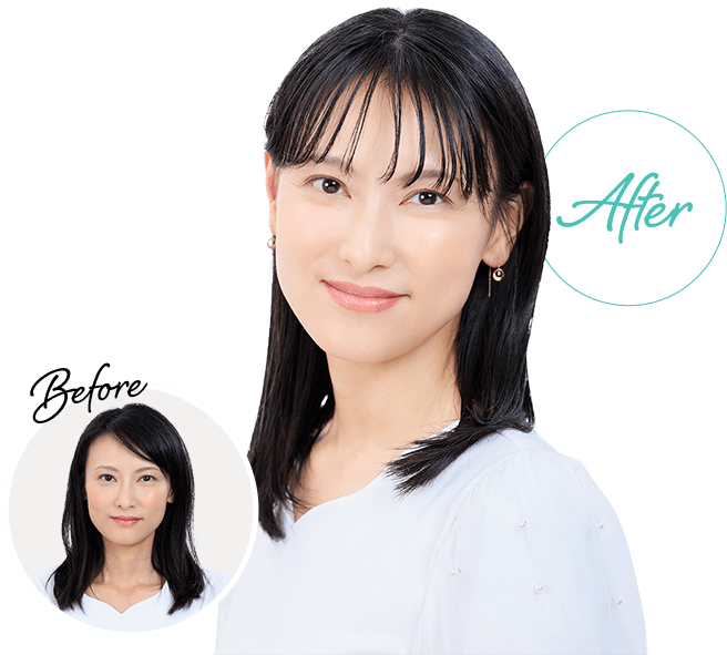 Before→After