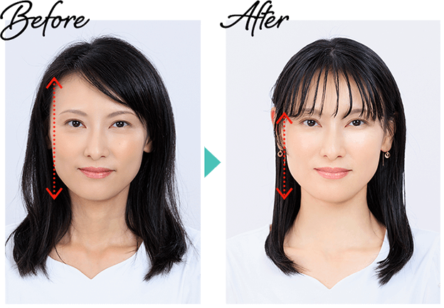 Before→After