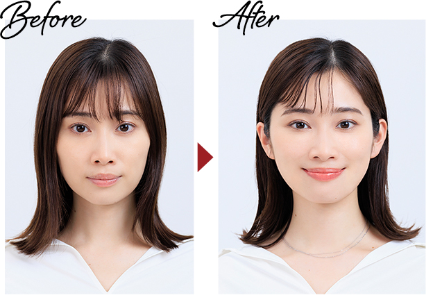 Before→After