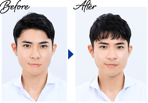 Before→After